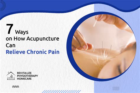 Ways On How Acupuncture Can Relieve Chronic Pain