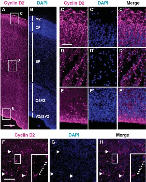 Cyclin D2 Protein Is Expressed In The Developing Human Cortex A E