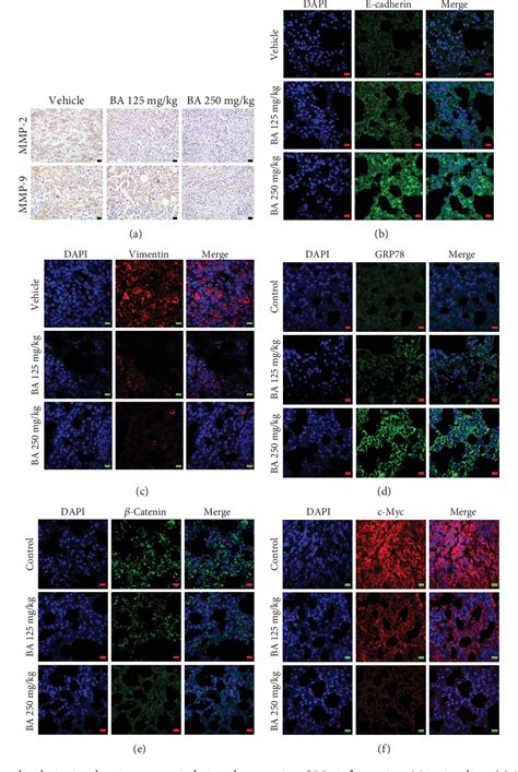 Figure From Betulinic Acid Suppresses Breast Cancer Metastasis By