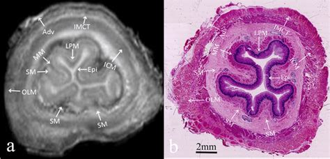 Normal Oesophageal Wall A Transverse Ex Vivo T2 Weighted Image