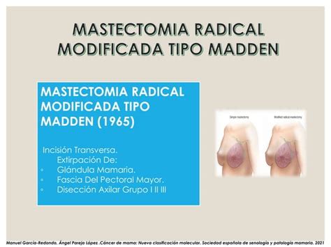 Cancer De Mama Ppt Residente De Ginecologia Y Obstetricia Ppt