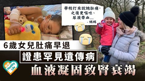 罕見病｜6歲女兒肚痛早退證患罕見遺傳病 血液凝固致腎衰竭 晴報 健康 生活健康 D230226