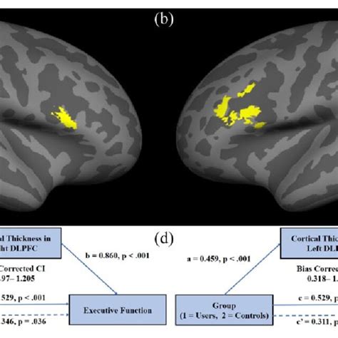 The Right A And Left B Dorsolateral Prefrontal Cortex Dlpfc