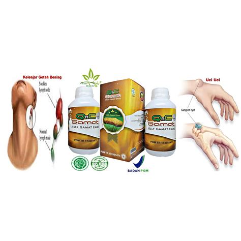 Obat Herbal Kanker Kelenjar Getah Bening Lipoma Uci Uci Gondok QnC