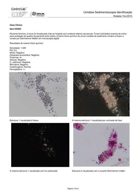 Pdf Urin Lise Sedimentoscopia Identifica O O Pdf Urin Lise