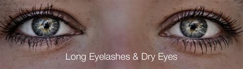 Eyelashes Dry Eye Dry Eye Master