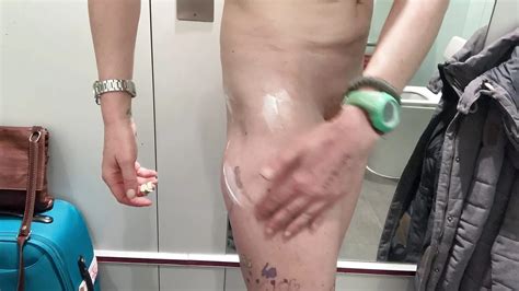 Naked At Heathrow And Massaging My Scarred Thigh And Ass Because Cancer