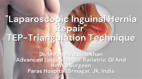 Laparoscopic Inguinal Hernia Repair Tep Triangulation Technique Tep