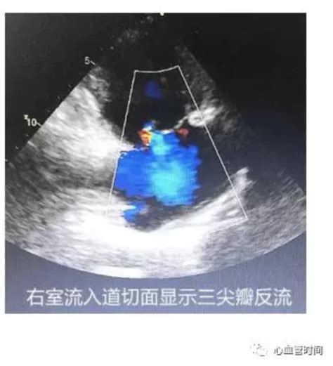 心脏超声：10 大切面，一文搞定！ 丁香园