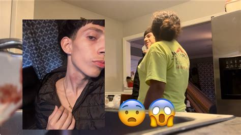 Hickey Prank On My Mom Youtube