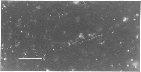 Dark Field Micrograph Of Spirochaete Like Objects In Culture Media With