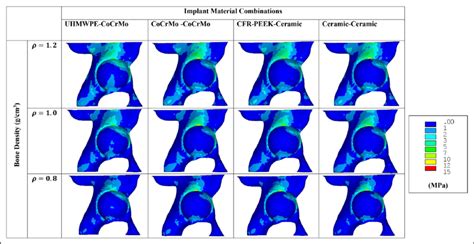 Comparison Of Von Mises Stress Mpa In Cancellous Bone With Different Download Scientific