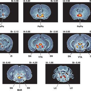 Expression Pattern Of The Tyrosine Hydroxylase TH Gene A Coronal