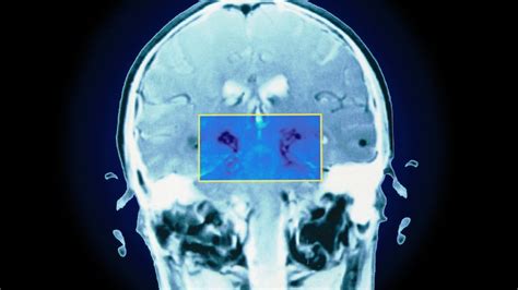 Our new health crisis — we’re diagnosing too much, too early