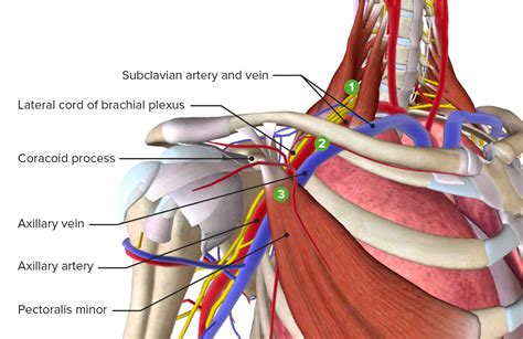 Thoracic Outlet Syndrom E Learning Mit Lecturio