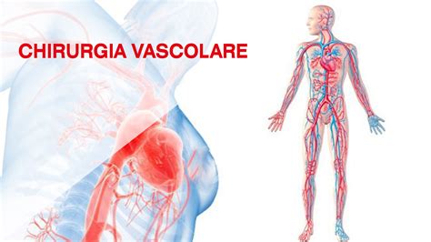 Chirurgia Vascolare Studi Medici D Onofrio A Castellaneta