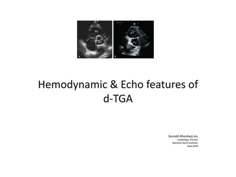 D tga, echo & hemodynamic features of | PPT