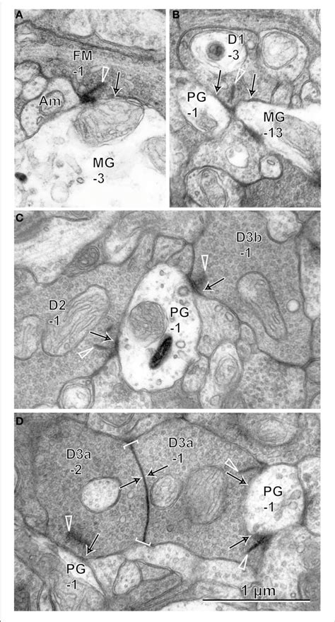 Electron Micrographs Of Synaptic Contacts Arrows Of OFF Bipolar