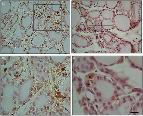 Photographs Of Rat Thyroid Tissue With HSP 90 Inmunohistochemistry Show