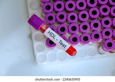 Hdl Test Look Abnormalities Blood Blood Stock Photo 2240635905