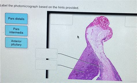 Solved Label The Photomicrograph Based On The Hints Chegg