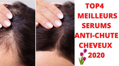 Top 4 Meilleurs Serums Anti Chute Cheveux 2020 Youtube