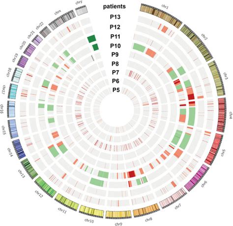 Full Article Sequential Whole Exome Sequencing Reveals Somatic