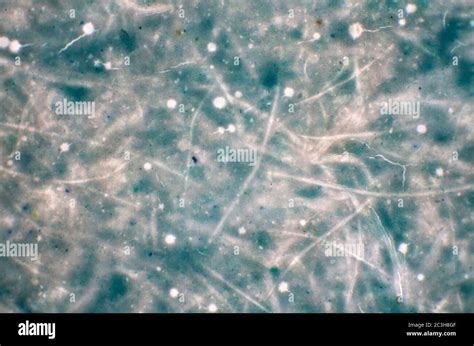 Penicillium Hongos Ascomicetos Fotograf As E Im Genes De Alta