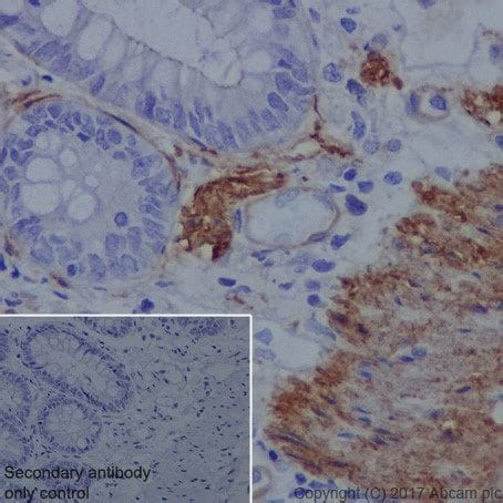 Recombinant Anti-Vinculin antibody [EPR20407] KO Tested (ab219649) | Abcam