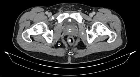 Identify The Structures Labelled A B C D E And F On This Axial