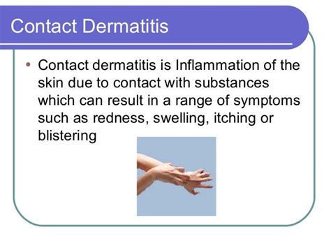 Dermatitisppt