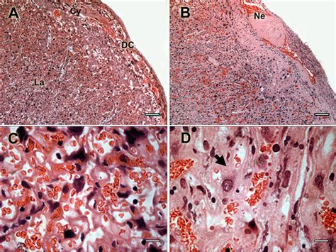 Placenta pathology in infected pregnant mice. Histology of infected...