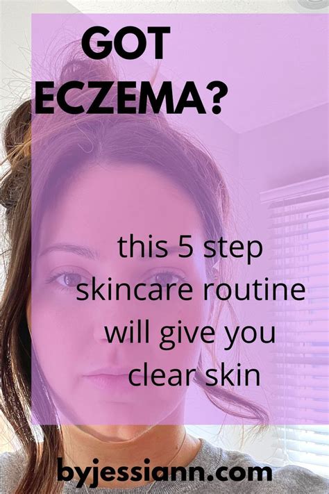 Eczema Skincare My 5 Step Routine That You Should Follow Too Artofit