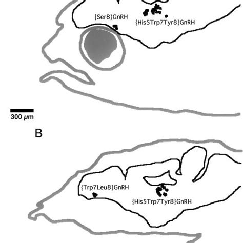 Camera Lucida Drawings Of Sagittal Sections Showing Gene Expression By