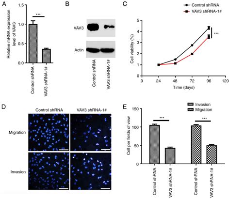 Vav3 Regulates Glioblastoma Cell Proliferation Migration Invasion And