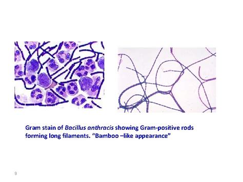 Diagnostic Microbiology Lecture 11 Gram Positive Endosporeforming Bacilli