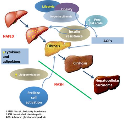 Liver Steatosis And Nonalcoholic Steatohepatitis From Pathogenesis To