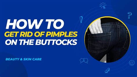 9 Easy Tips How To Get Rid Of Pimples On The Buttocks 2024