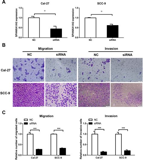 Knockdown Of Spanxa A Inhibits The Malignant Phenotype Of Tumor