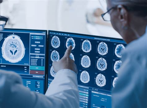 The Life Of A Radiologist Full Breakdown TheMDJourney