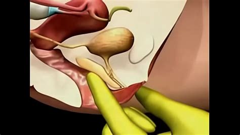 Point G Free Mobile Porn Videos IPornTV