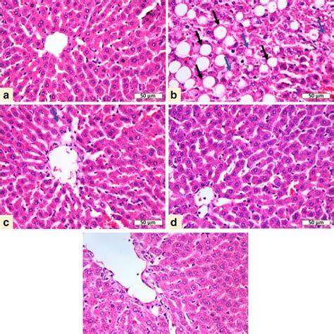 Photomicrographs Of Liver Sections Of A Control Rats Showing Normal Download Scientific Diagram