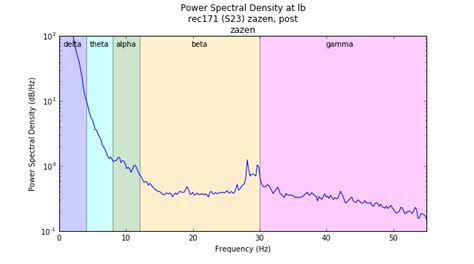 Eeg Spectral Analysis