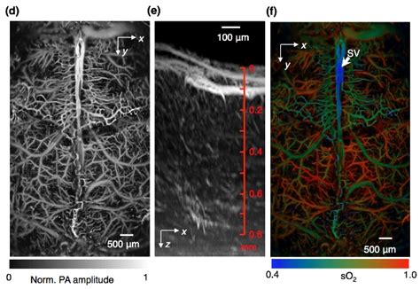 Photoacoustic Microscopy High Speed Imaging Of Functions In Living