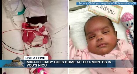 Micro-preemie born at 22 weeks heads home from the hospital: 'She's a ...