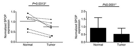 Expression Of Speckle‑type Poz Protein Spop Messenger Ribonucleic