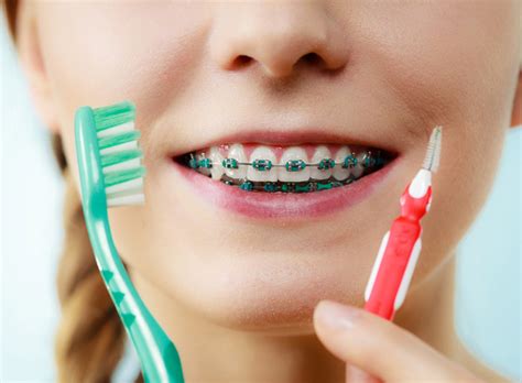 Oral Hygiene With Braces Dr Thomas Montemurno Orthodontics