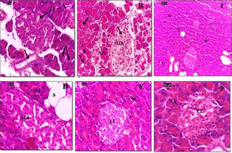 Histopathological Sections Of The Pancreas In Rat With Hande Stain A