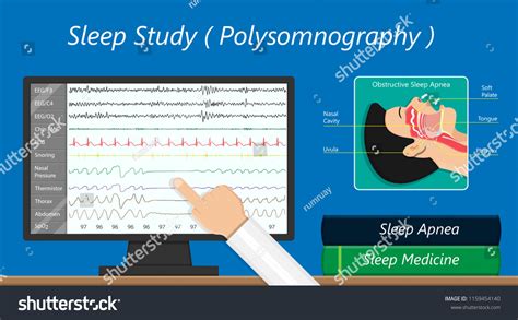 Psg Sleep Study Test Apnea Diagnose Stock Vector Royalty Free