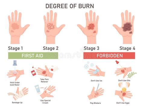 First Degree Burn Stock Illustrations 110 First Degree Burn Stock